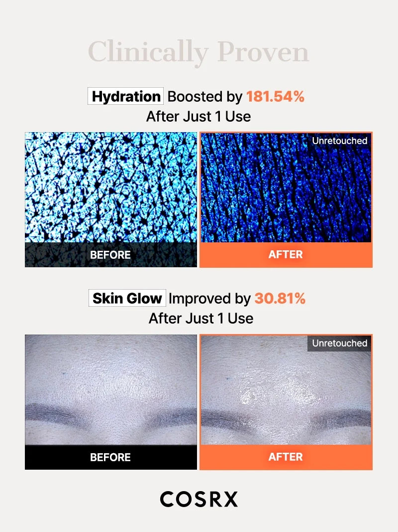 COSRX 5 PDRN Hyaluronic Acid Vital Hydrating Hydrogel Mask 3ea — product detail image 6