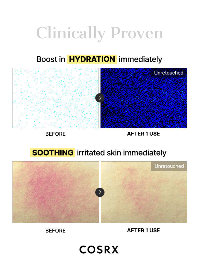 COSRX Advanced Snail Mucin Glass Glow Hydrogel Mask 3ea — product detail image 8