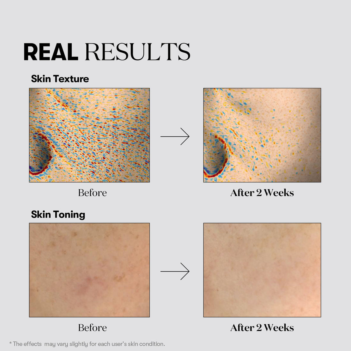 VT Cosmetics TX-Toning Essence 1000 Shot 30ml - official product image 6