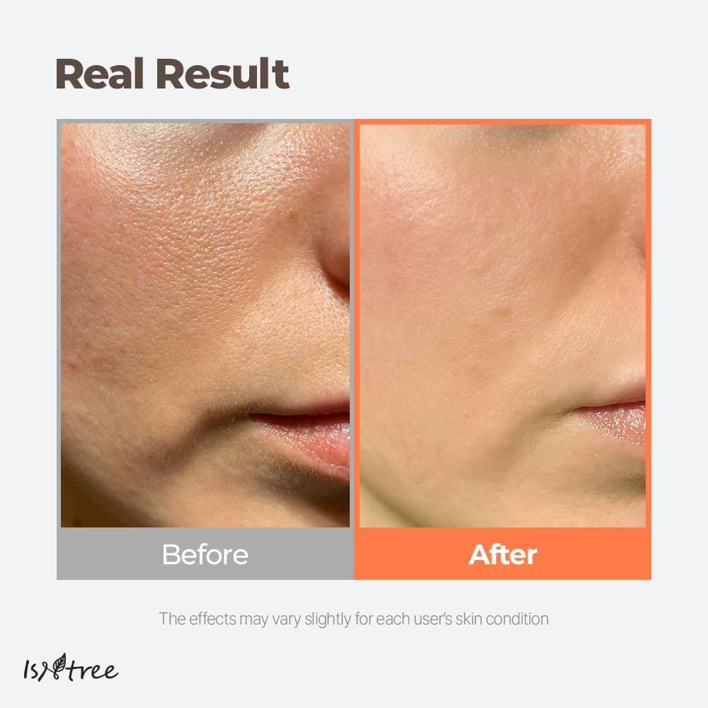 Isntree Green Tea Fresh Toner 200ml — Toners &amp; Astringents product image 52
