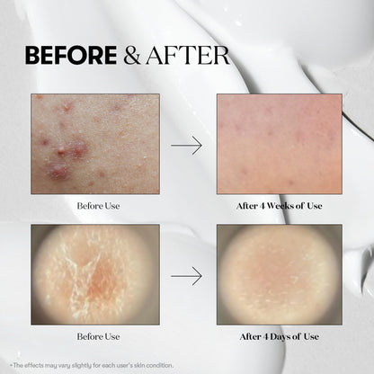 VT Cosmetics 300 Reedle Shot 10ea - official product image 6
